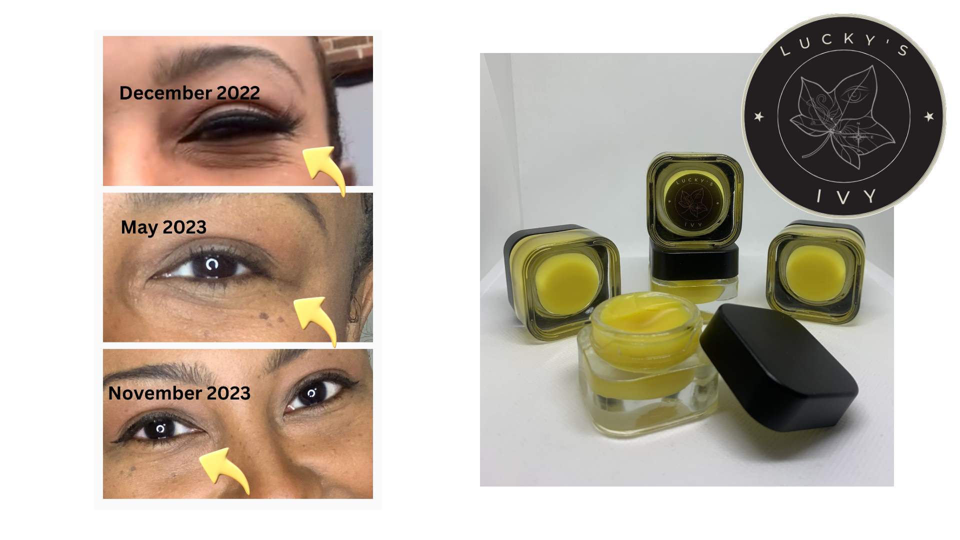 Golden Night Under-Eye Balm – before-and-after eye images showing reduction of fine lines, wrinkles, and signs of stress, plus multiple jars of the eye balm with clean ingredients.